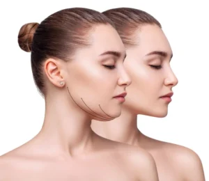 face slimming